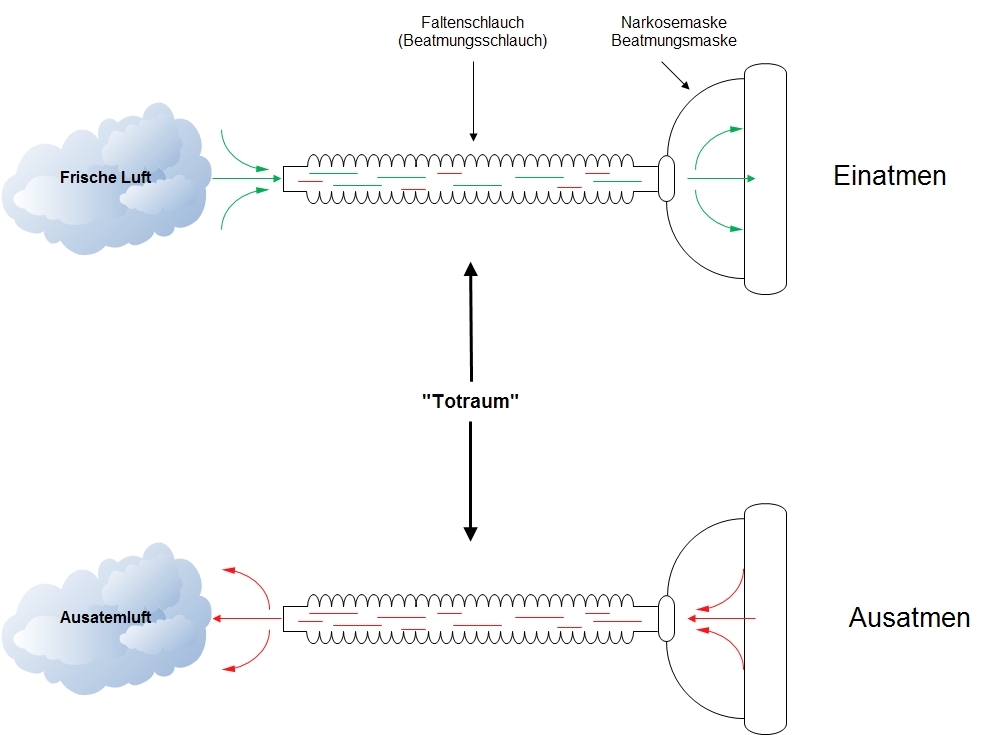 Totraum bei einem Beatmungsschlauch